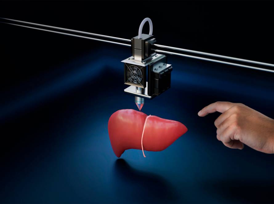 Laser cutting
